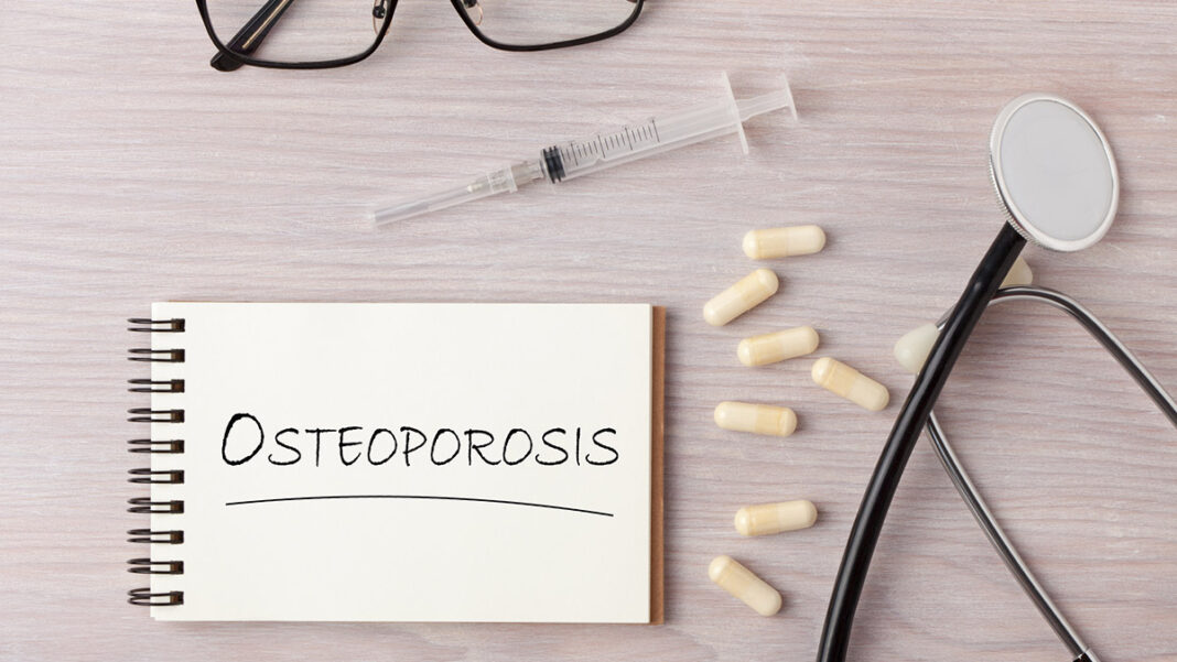 Can Osteoporosis Be Reversed